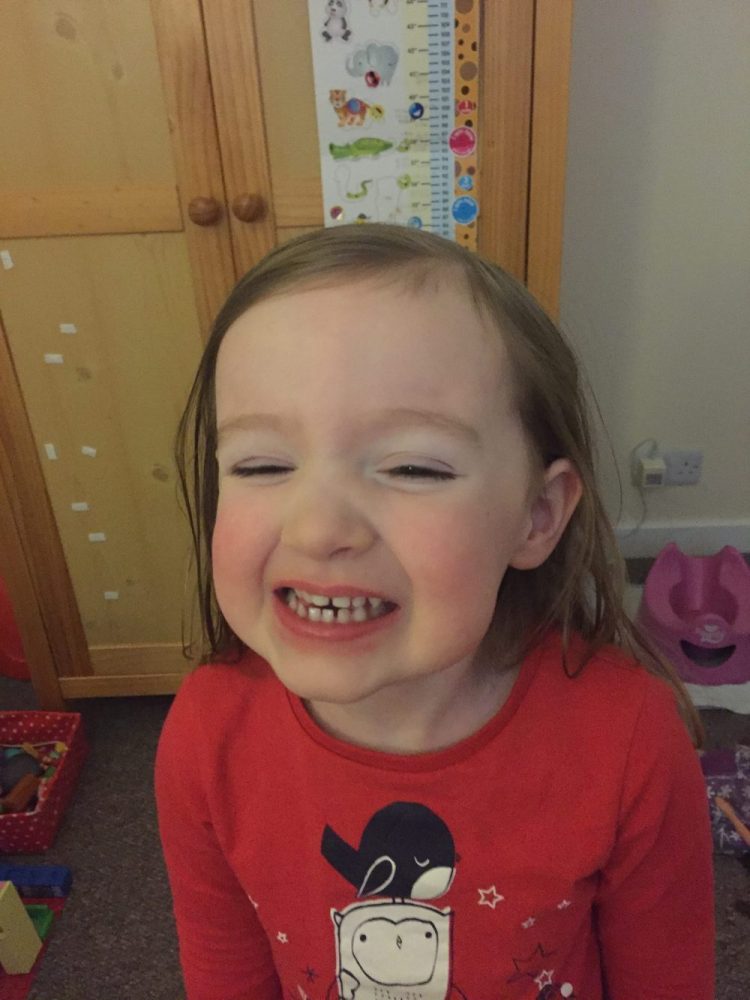 Preventing Head Lice